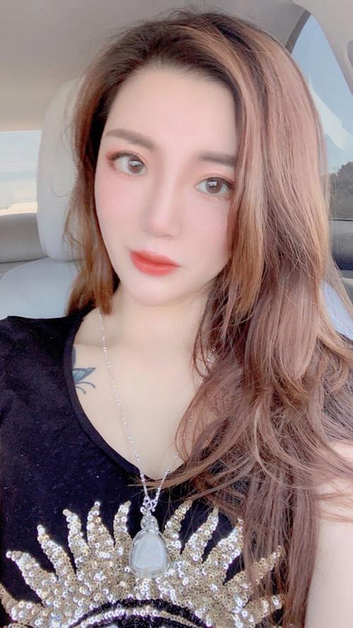 女性脸色暗黄是什么原因引起的相关介绍