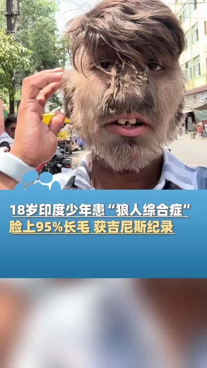 久久久久久久激情综合片的相关介绍